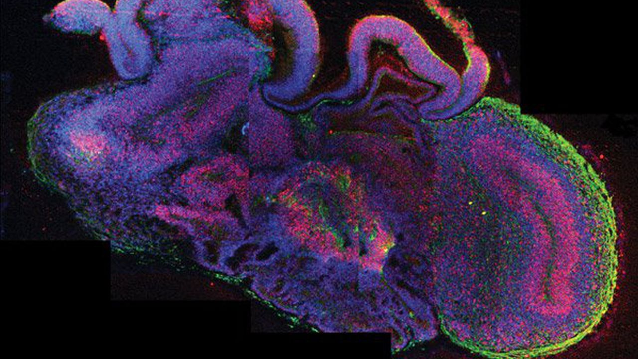 Отгледаха миниатюрен човешки мозък в лабораторна среда