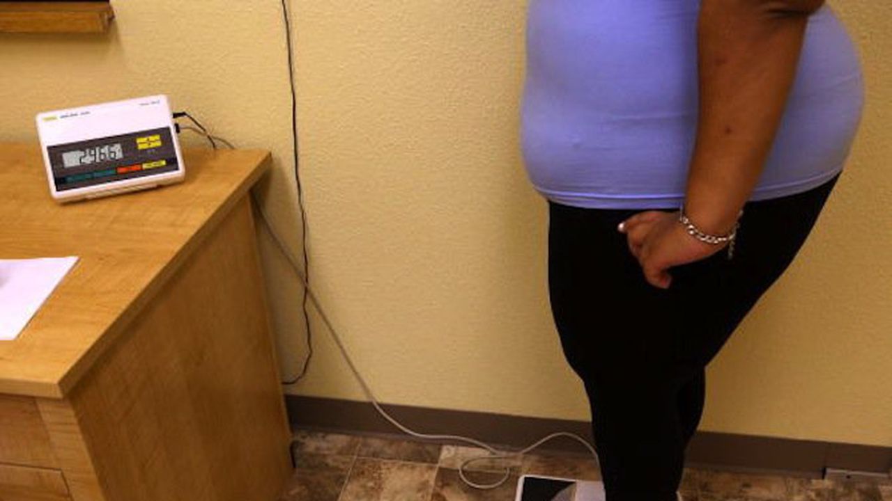 Затлъстяването съкращава живота с 1 до 8 години