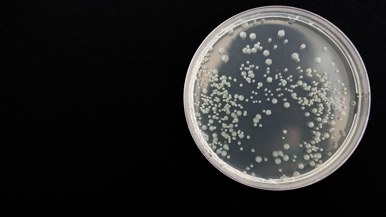 Проба със съмнения за опасна бактерия се изследва в Центъра