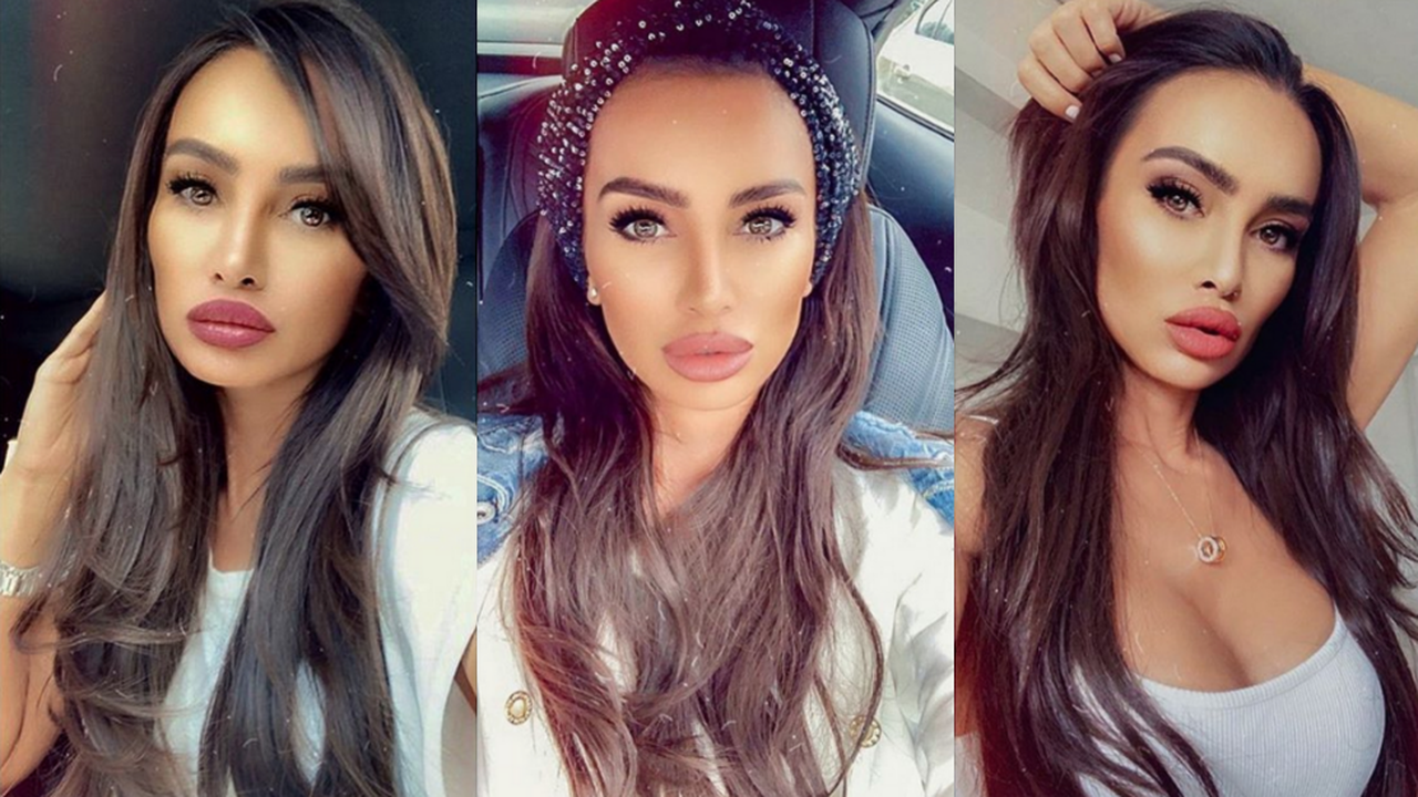 Биляна Дол опъва бръчки в Швейцария