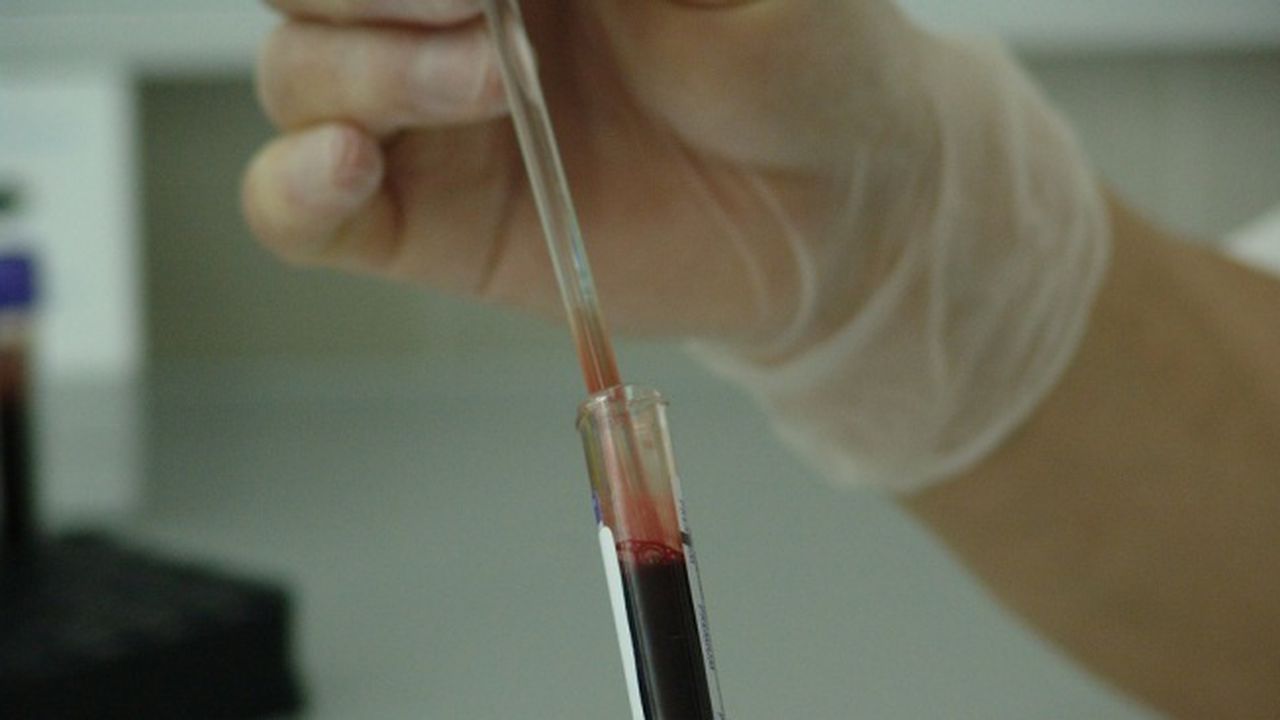 Започва кампания за безплатно изследване за хепатит С