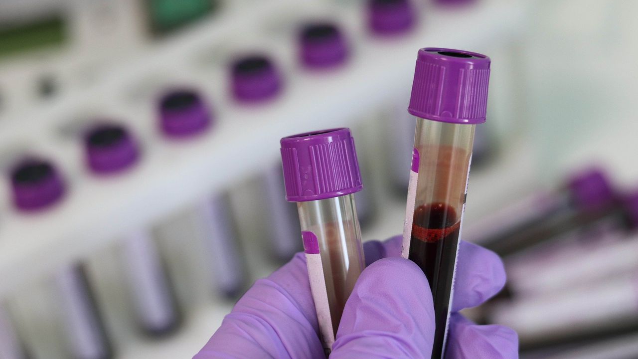 Двама души от тунджанското село Тенево са положителни за COVID-19