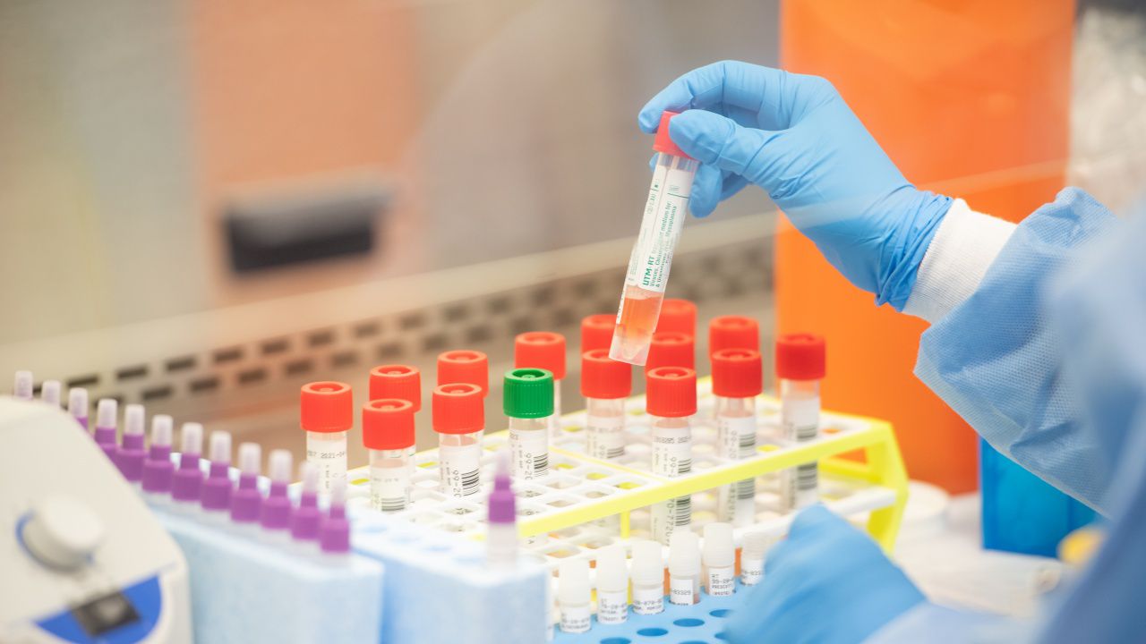 Кипър отчете рекорд в броя на случаите с коронавирус