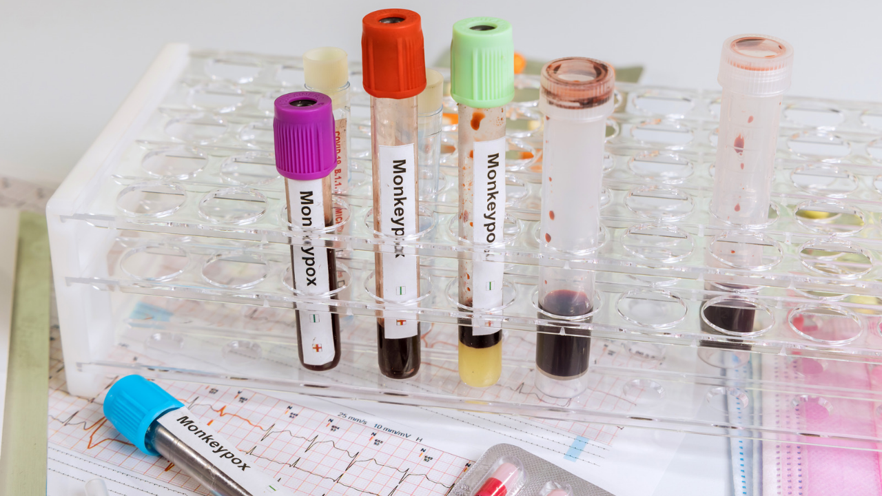 СЗО възнамерява да преименува маймунската шарка