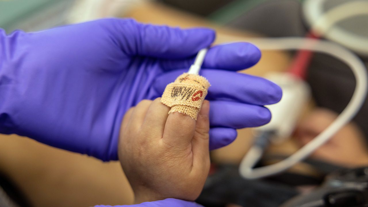 Мистериозният щам на хепатит при децата достигна до Азия и Канада