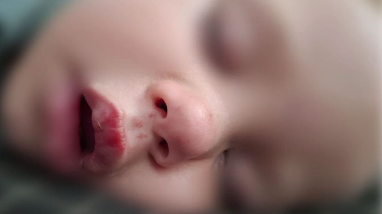 "Страх го е от всеки силен звук": Майката на пострадало дете настоява за забрана на тротинетките в Плевен