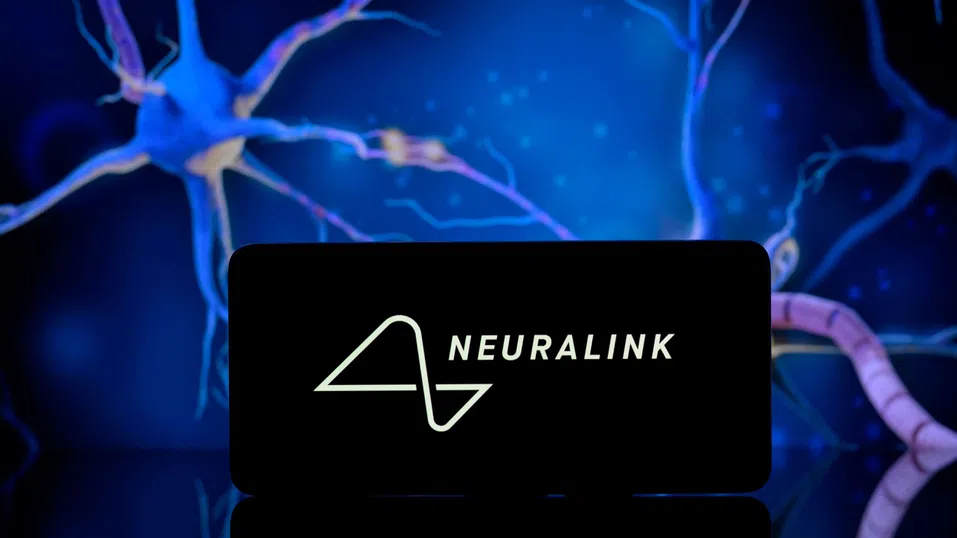 Пациентите с чип Neuralink в мозъка вече могат да движат роботизирани крайници