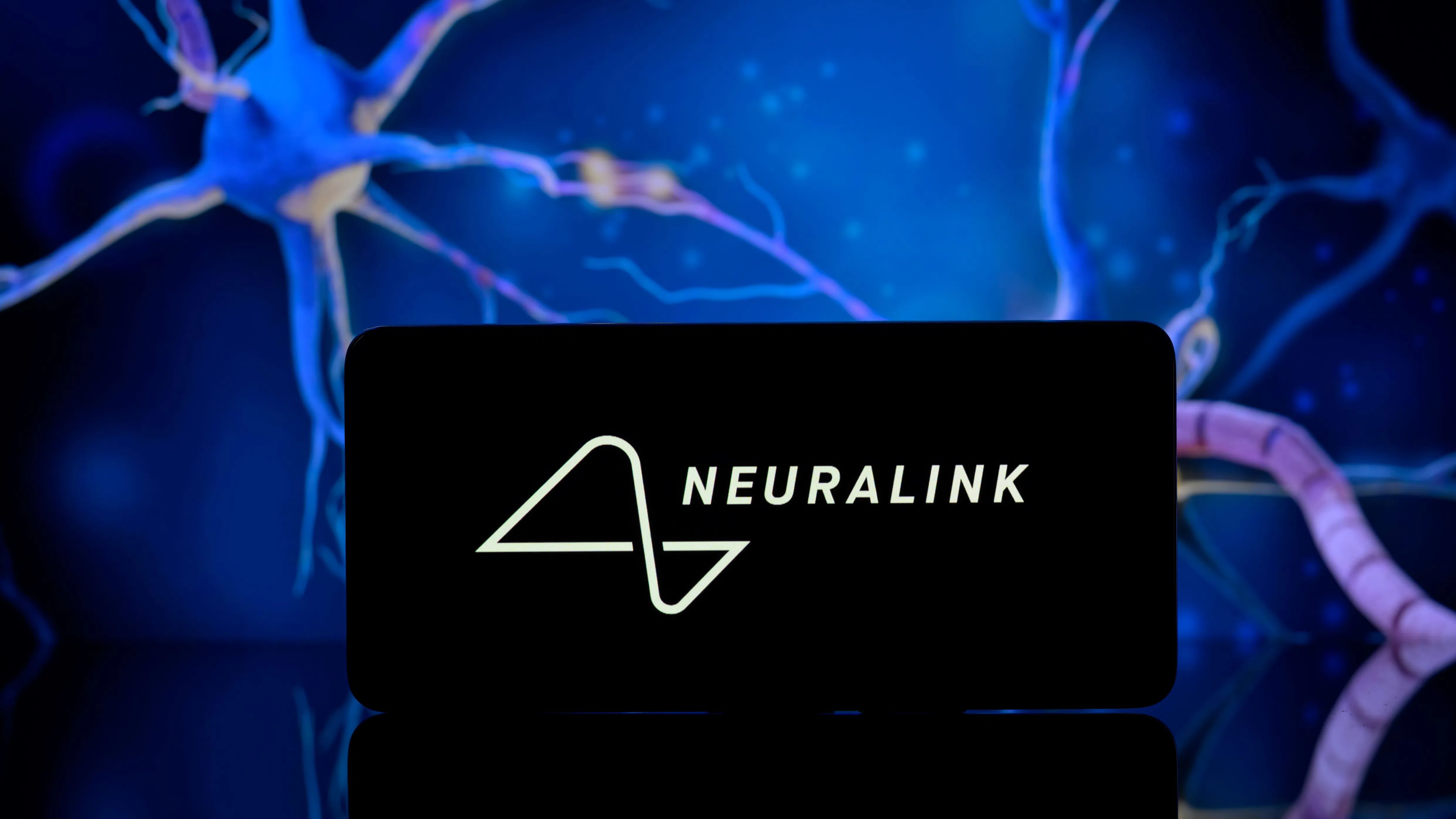 Първият мозъчен имплант на Neuralink се сблъска с проблем