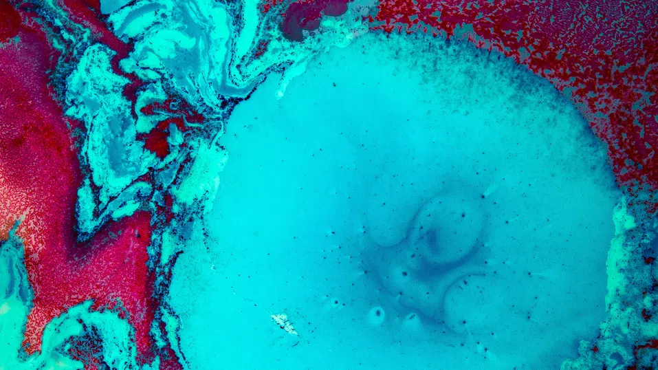 Революция в пластичната хирургия: Нов тип клетки може да са тайната за по-естествени импланти