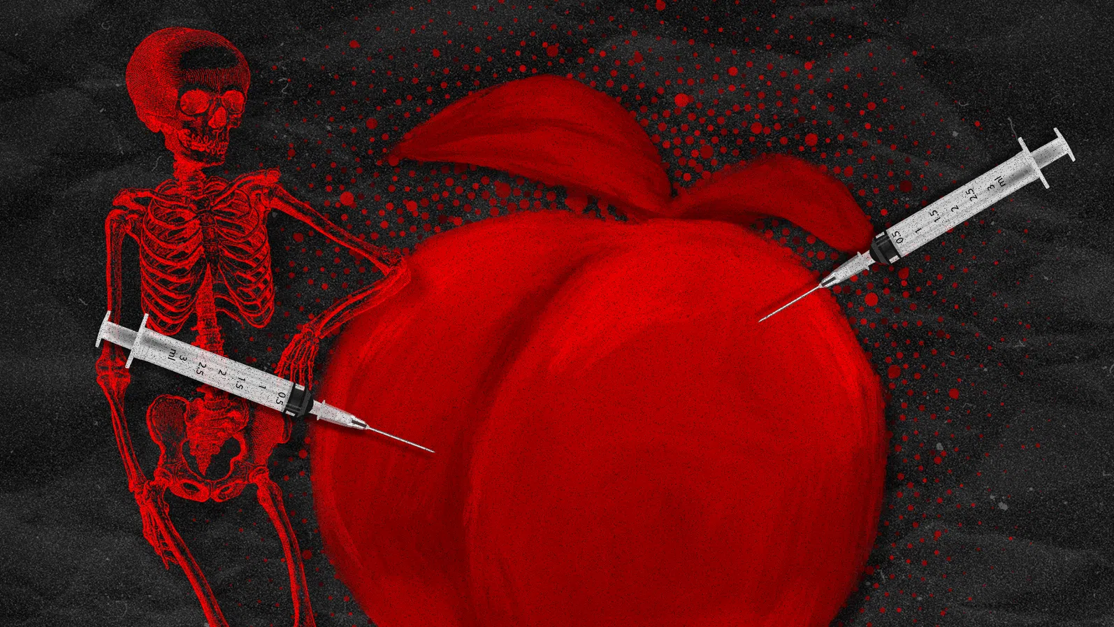 Пластичната хирургия откри нов ресурс - мастна тъкан от трупове