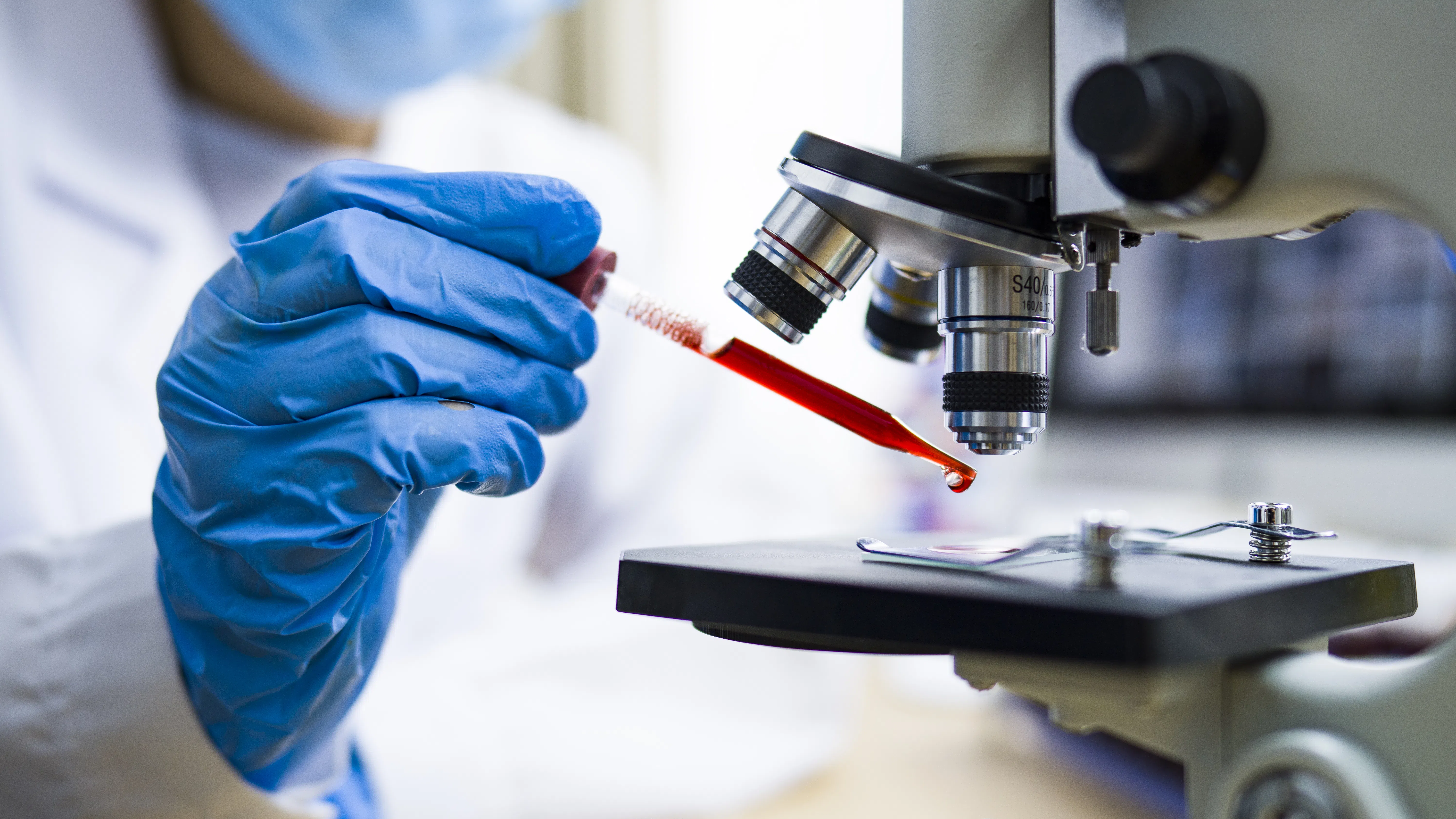 Само 50 души в света имат „златна кръв“ – и науката иска да я пресъздаде в епруветка