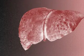 Може ли изкуственият интелект да промени диагностиката на чернодробните заболявания?