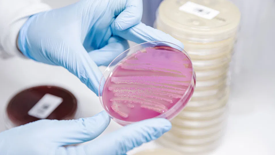 AI разработва антибиотици за гонорея и супербактерии