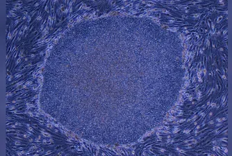 Регенеративната медицина прави крачка напред след одобрение на терапии с iPS клетки в Япония