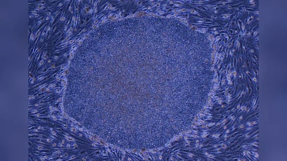 Регенеративната медицина прави крачка напред след одобрение на терапии с iPS клетки в Япония