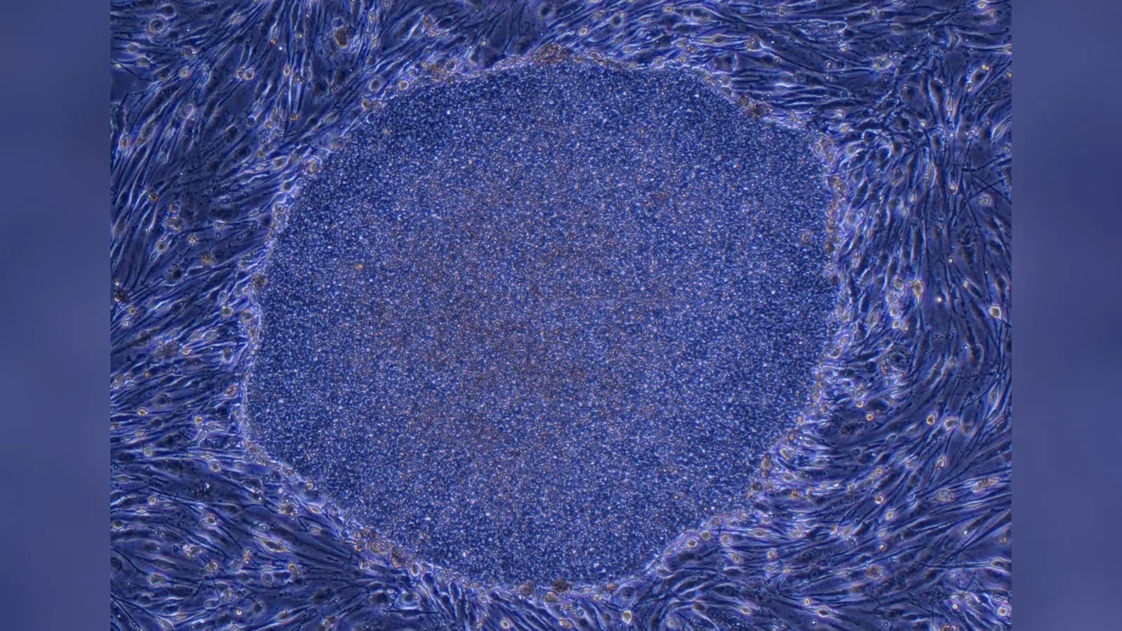 Регенеративната медицина прави крачка напред след одобрение на терапии с iPS клетки в Япония