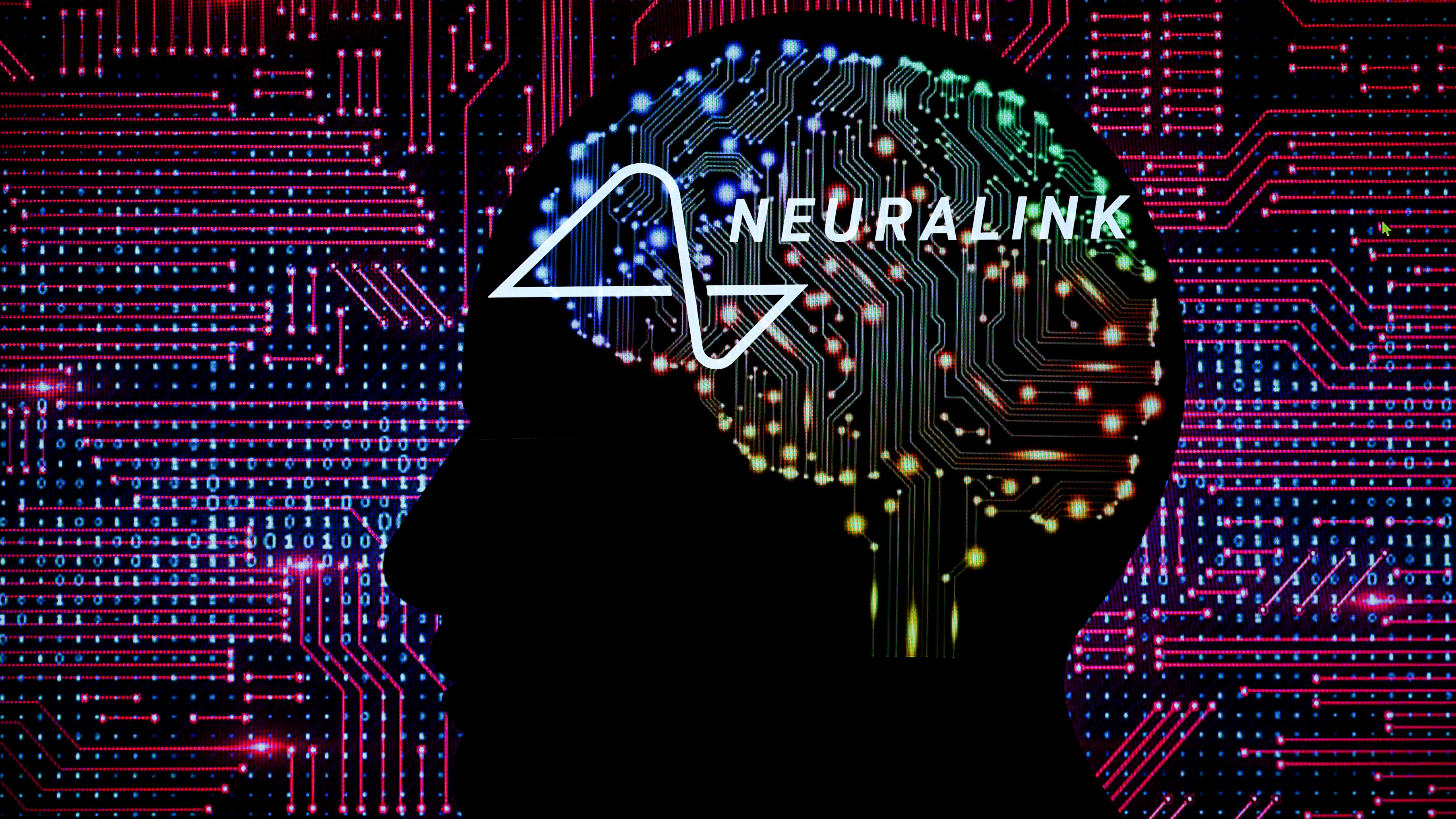 Neuralink търси втори пациент за мозъчен имплант - има ли доброволци?