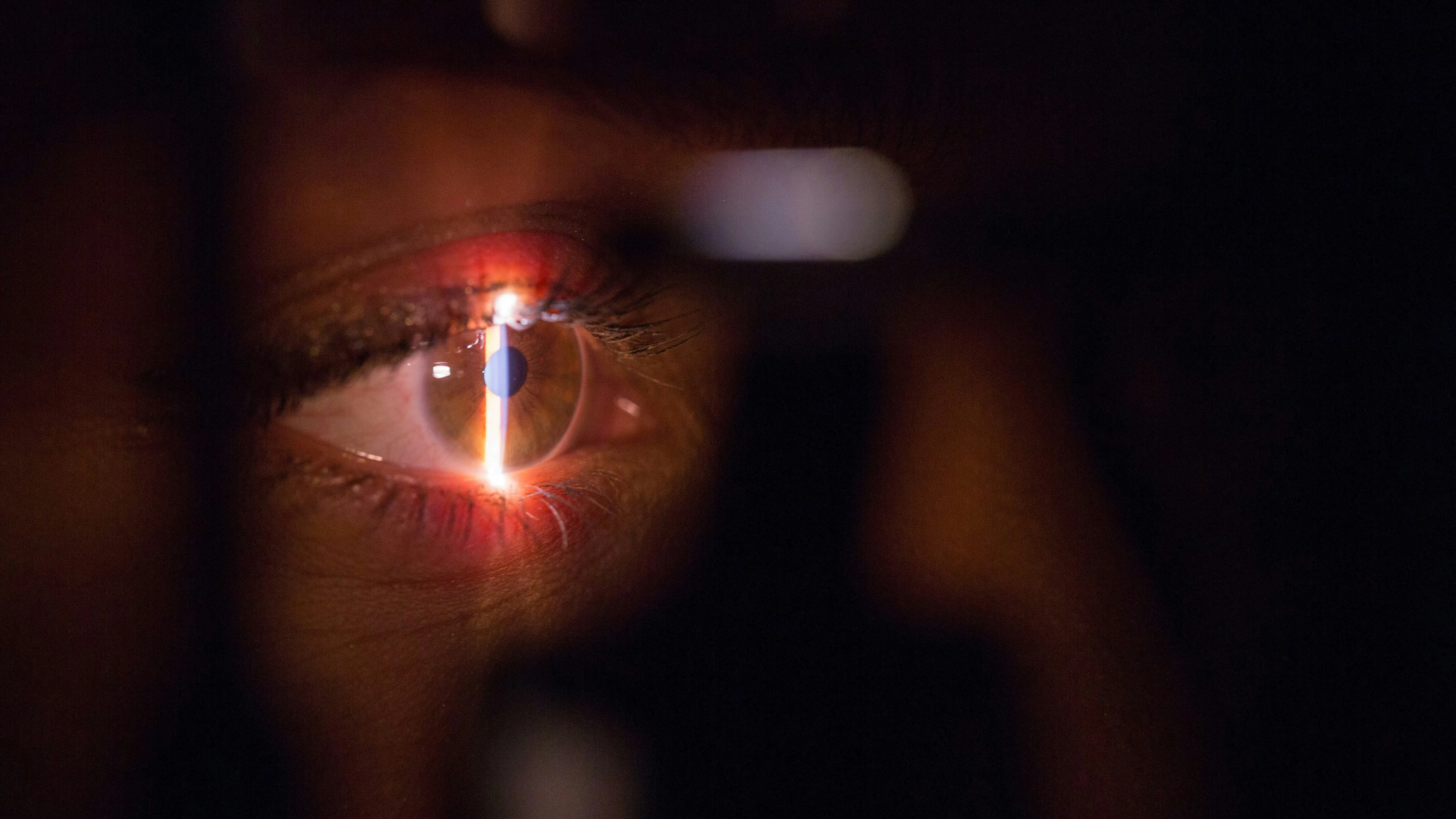 Защо сканирането на очите от Worldcoin е страховита, но все пак добра идея