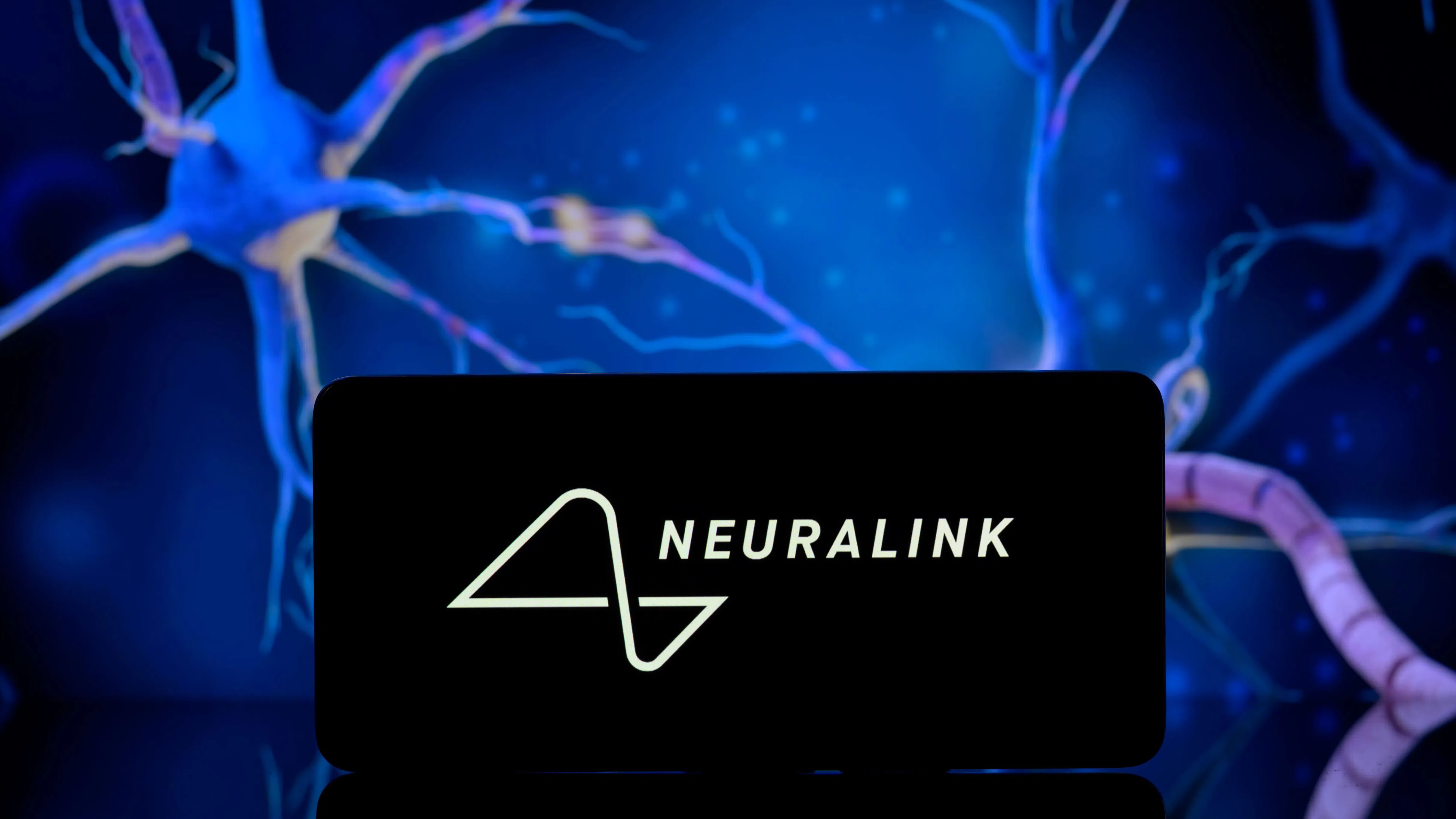 Първият пациент на Neuralink може да управлява курсор чрез мисъл