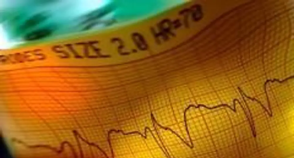 Moderate Optimism Expected on BSE Today