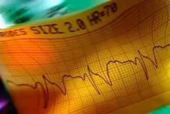 Moderate Optimism Expected on BSE Today