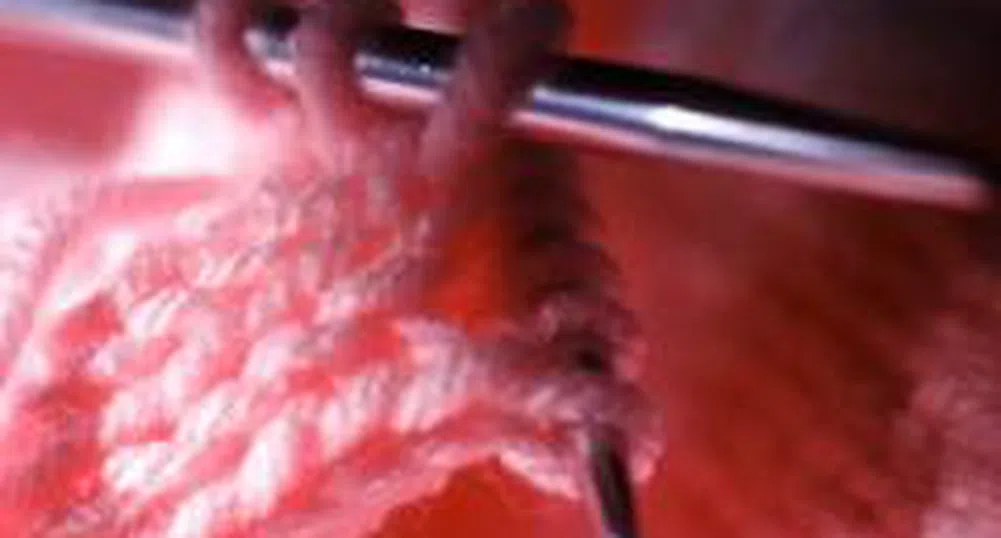 Хотелиери привличат туристи с плетене на чорапи