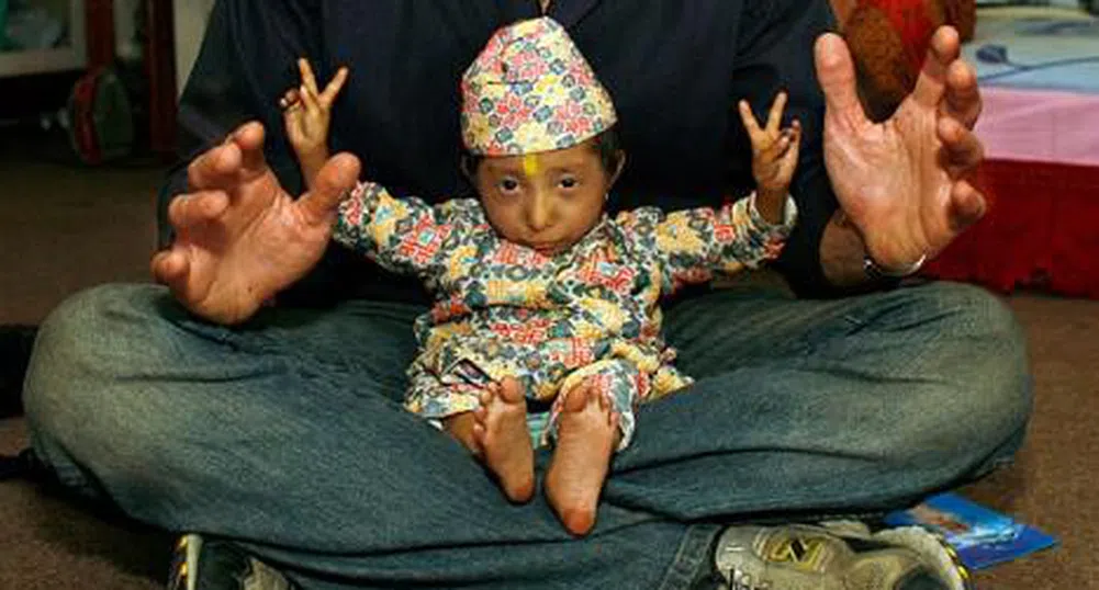 Непалско момче бе признато за най-ниския мъж в света