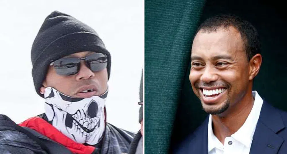 Най-странните контузии на спортисти