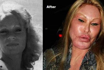 Жените с най-много пластични операции