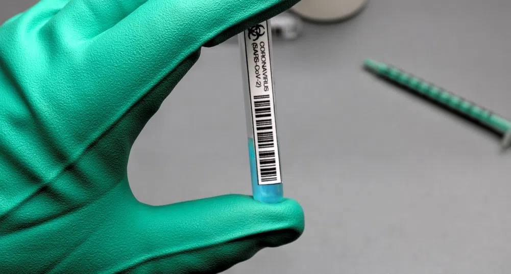 Кои грешки водят до фалшив резултат при тестване за коронавирус?