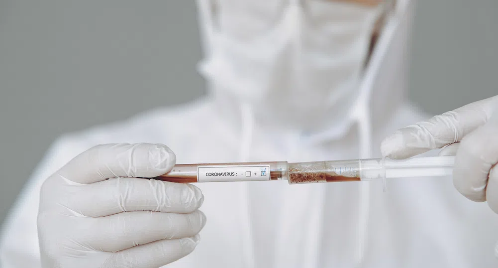 Чехия изисква отрицателен тест за COVID-19 на работниците от България