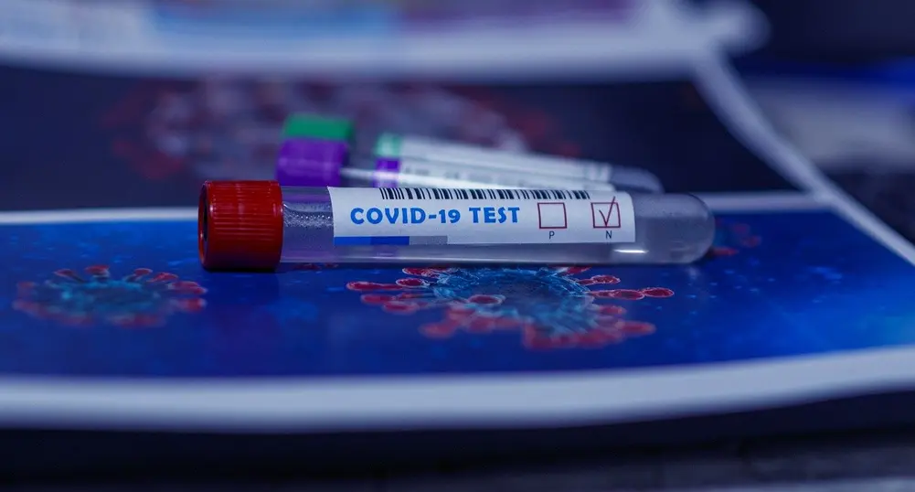 Потвърдените случаи на COVID-19 у нас вече са над 20 000