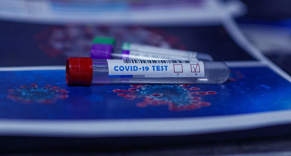 София начело по брой заразени с COVID-19