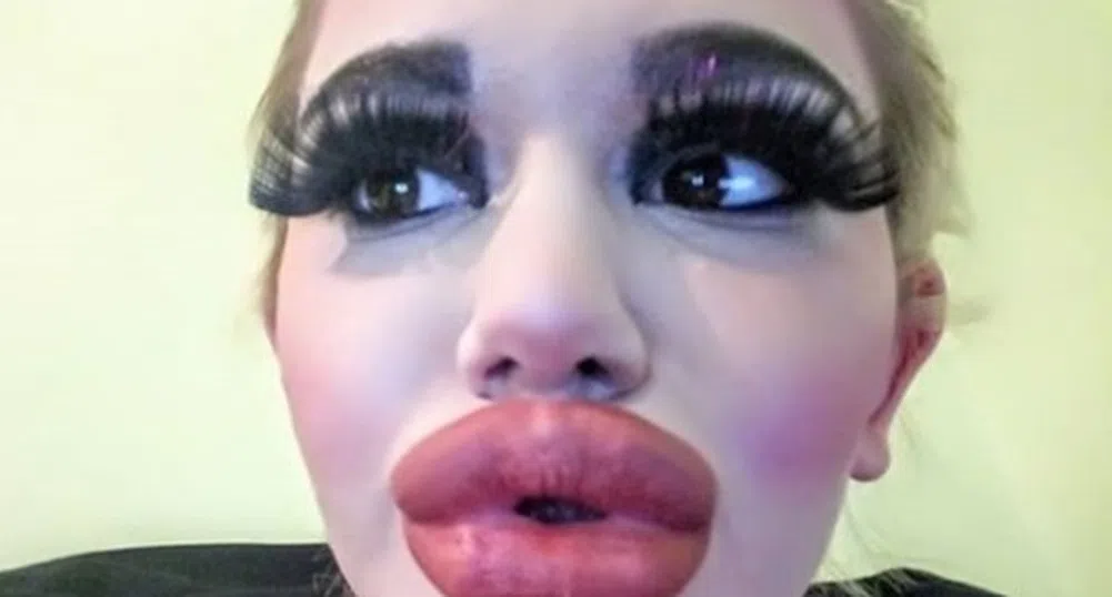 Жената с най-големи устни в света е българка