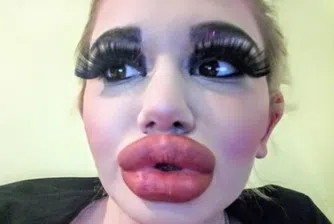 Жената с най-големи устни в света е българка