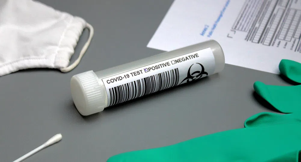 3 899 новозаразени с COVID-19 за 24 часа у нас, 847 са излекуваните