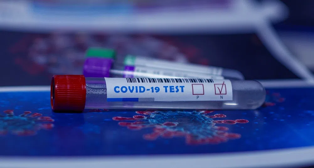 Под 100 нови случая на COVID-19 за последното денонощие