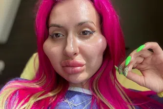 Жената с най-големи скули в света смята, че те все още са малки (снимки)