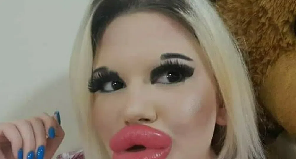 Андреа Иванова - българката с най-големите устни в света