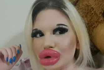 Андреа Иванова - българката с най-големите устни в света