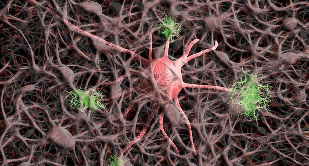 Учени от MIT направиха исторически пробив в борбата с болестта на Алцхаймер