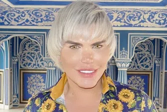 Той е горд с 60-ата си пластична операция, прости се с 4 ребра