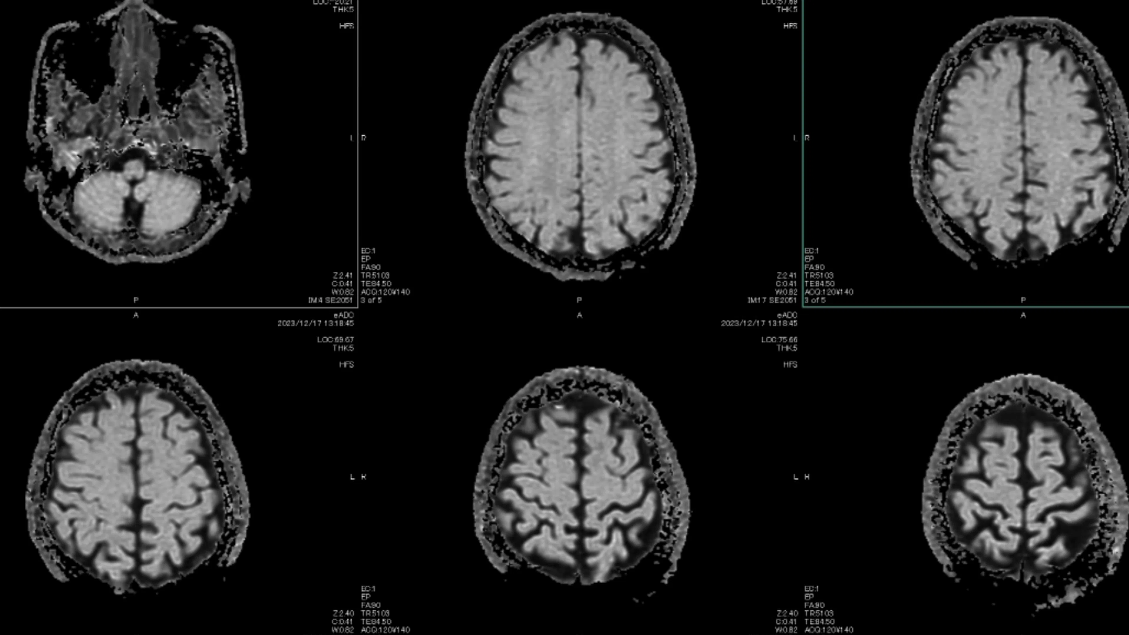Учени идентифицират пет „епохи“ в развитието на човешкия мозък