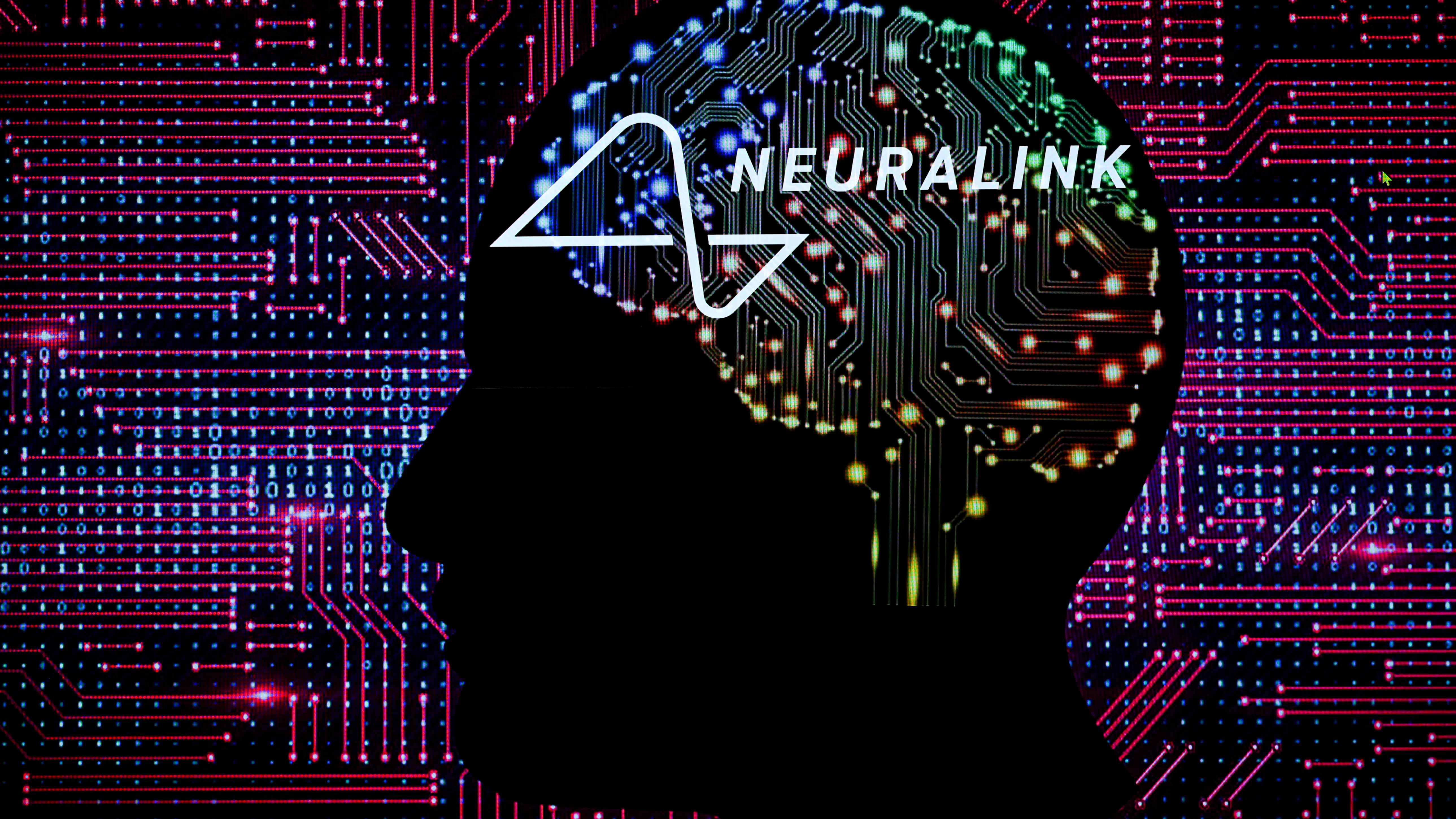 Трети пациент получи мозъчен имплант от Neuralink