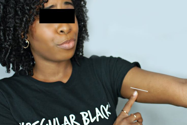 Santé : 5 choses à savoir avant de prendre un implant contraceptif