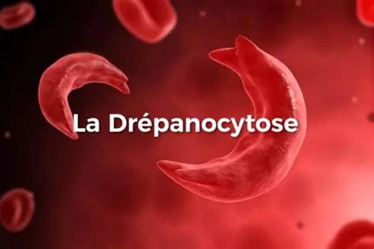 DRÉPANOCYTOSE : TOUT CE QU'IL FAUT SAVOIR POUR COMBATTRE L'IGNORANCE QUI TUE