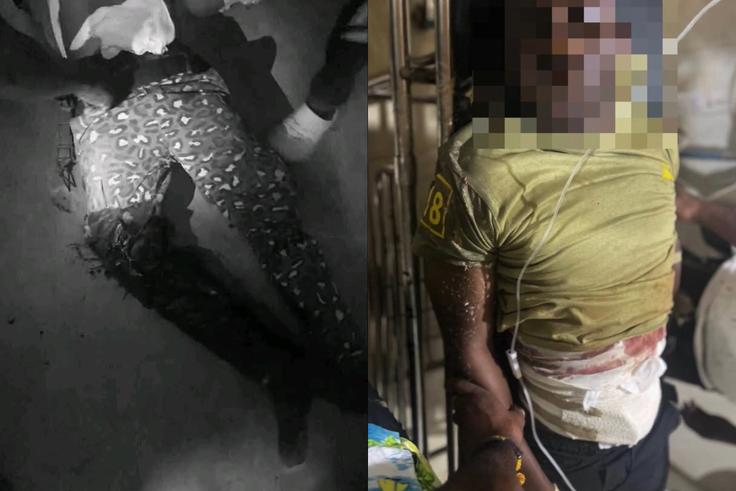 U/E: 2 Ghana immigration officers ambushed and shot at Nagani