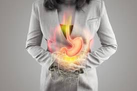 Acid Reflux