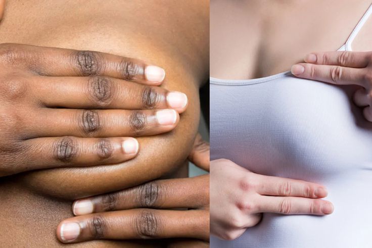 How to Keep Your Nipples Clean: Important Tips Every Young Lady Should Know