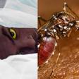 Gov’t declares Yellow fever outbreak in Upper West after 3 confirmed dead; Here's what you need to know